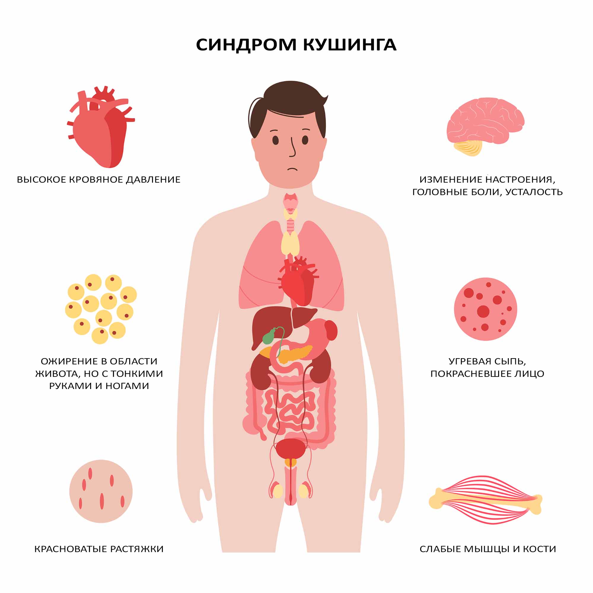 Симптомы гиперкортицизма